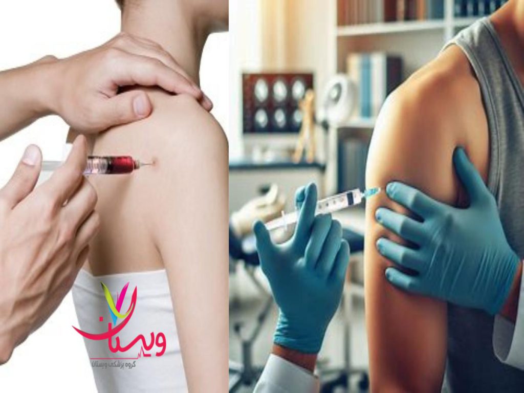 تزریق پی آر پی هزینه پی آر پی شانه با بیمه آتیه سازان حافظ