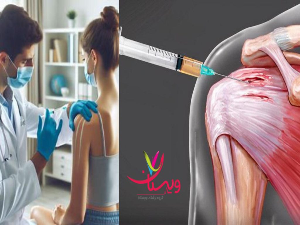 پی آر پی هزینه پی آر پی شانه با بیمه تکمیلی