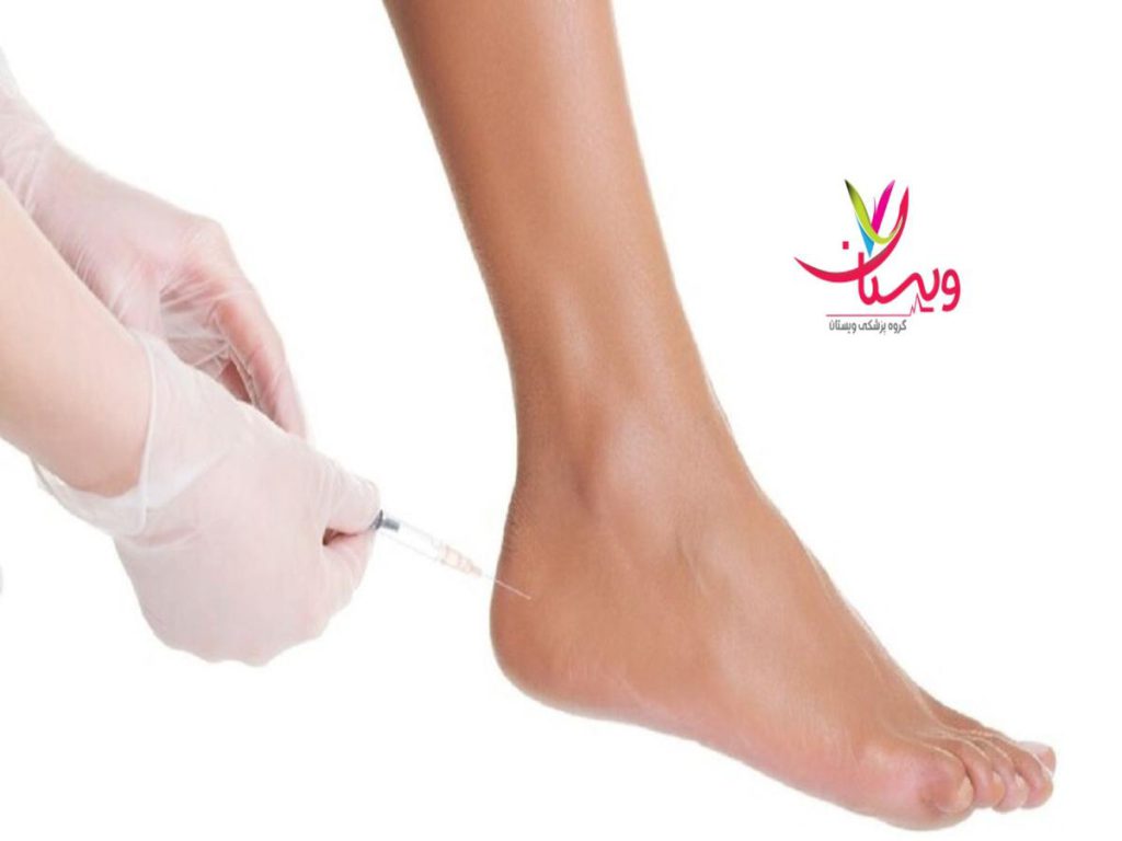 تزریق پی آر پی مچ پا در تهران بهترین مرکز برای تزریق پی آر پی مچ پا در غرب تهران