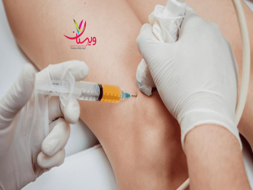 درمان مشکلات مفصلی بهترین مرکز پی آر پی تهران