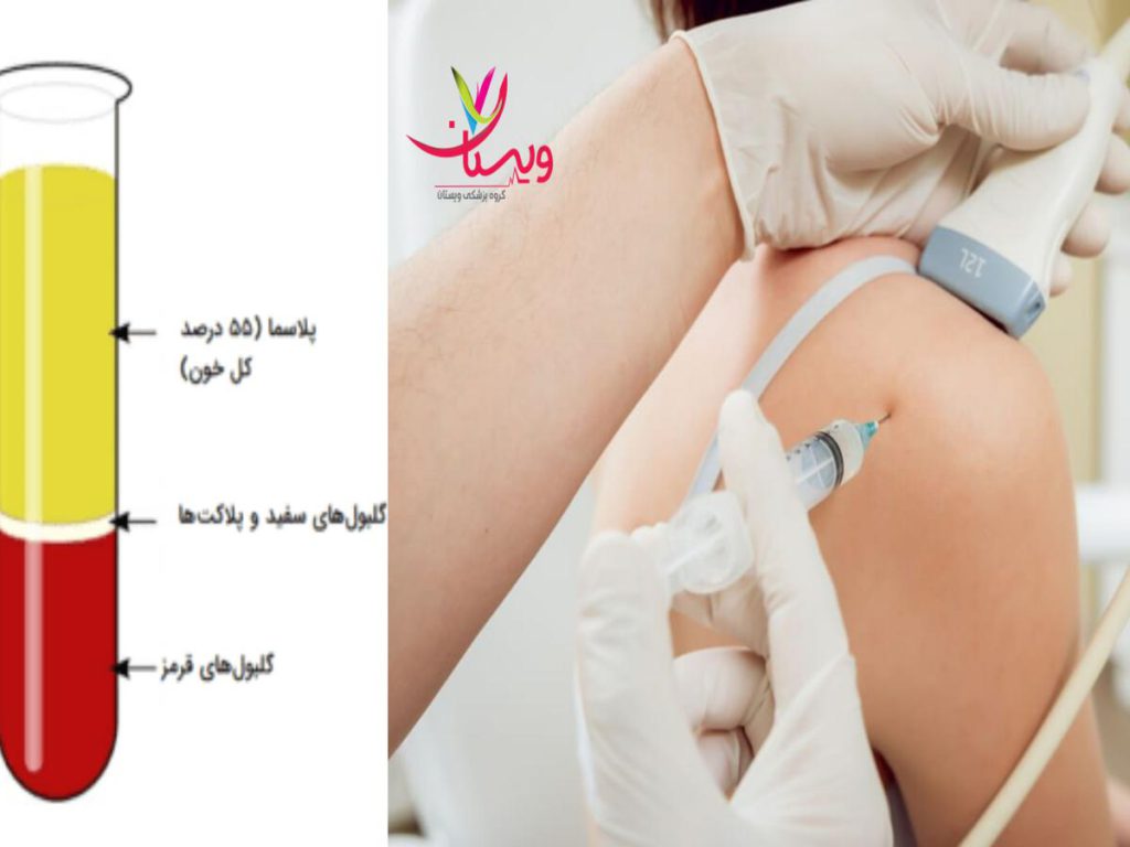 کلینیک تخصصی ایمان بهترین مرکز پی آر پی شانه در تهران