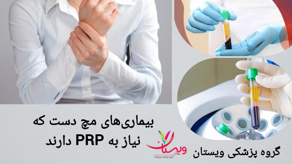 درمان مشکلات مچ دست با پی آر پی بیمار دچار درد مچ دست شده و پزشک خون بیمار را برای انجام پی آر پی آماده می کند.