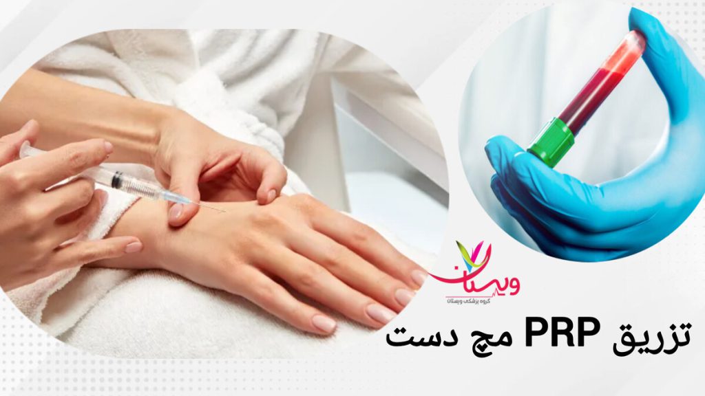 درمان درد مچ دست با پی آر پی پزشک در حال تزریق پی آر پی مچ دست برای درمان بیماری