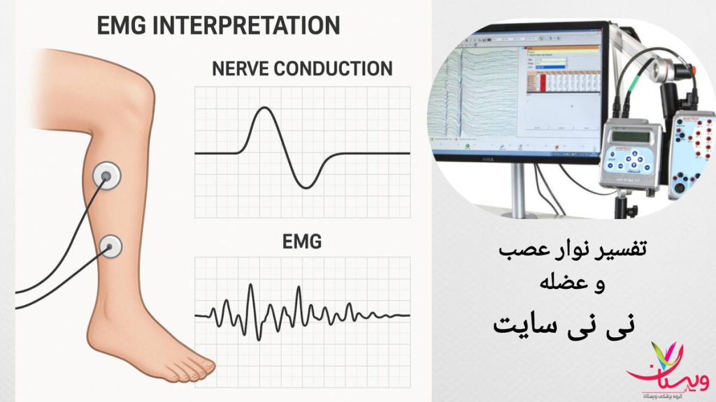 نظریات کاربران نی نی سایت در مورد تفسیر نوار عصب و عضله عکس نوار عصب و عضله روی مانیتور