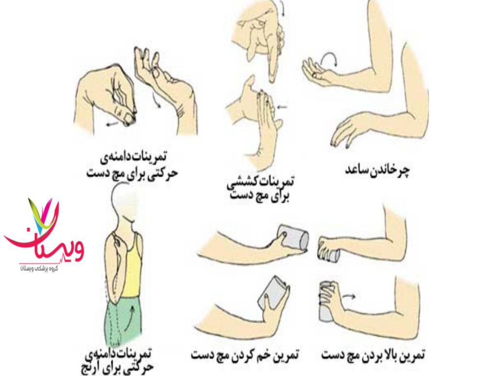 کشش عضلات ساعد درمان تنیس البو با ورزش