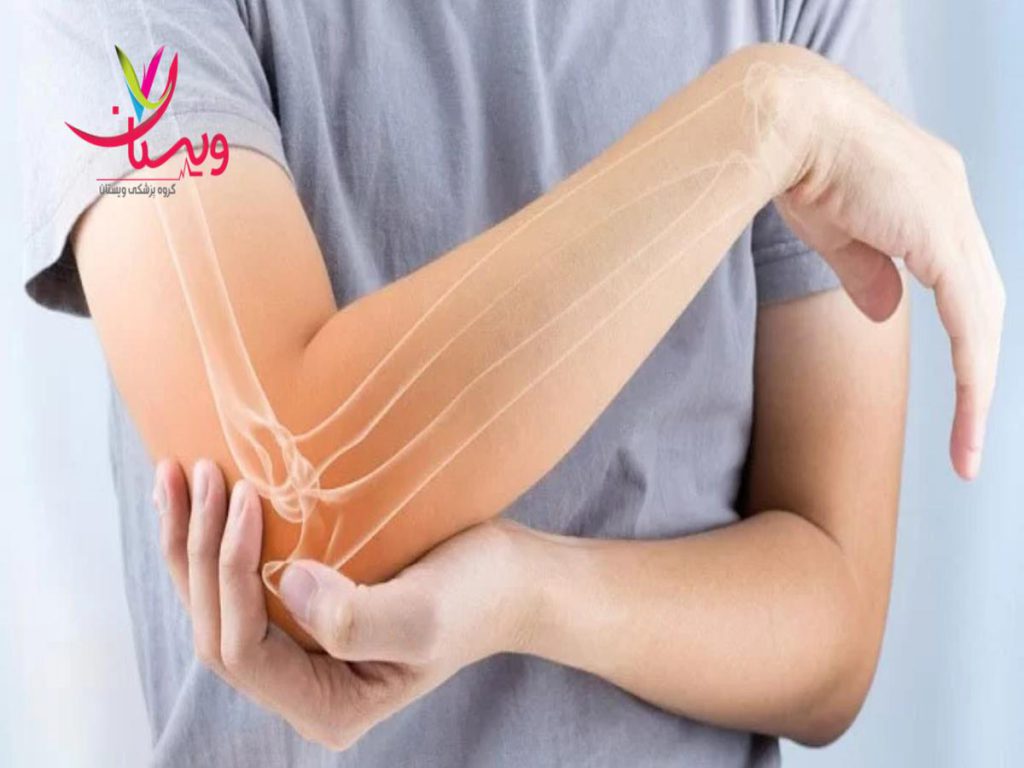 داروهای شلکننده عضلات درمان دارویی تنیس البو
