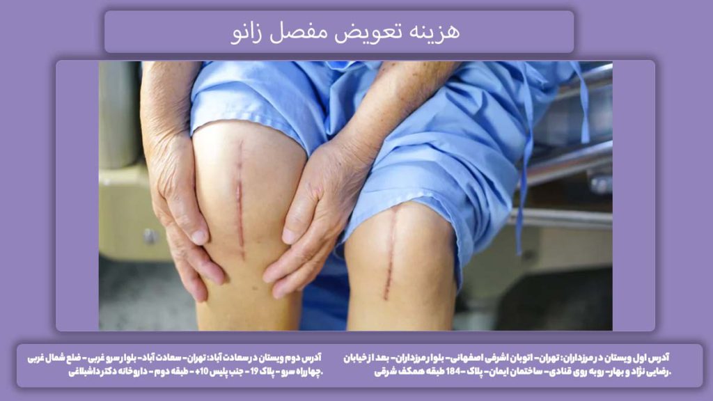 تعرفه عمل پروتز زانو هزینه جراحی مفصل ناحیه زانو