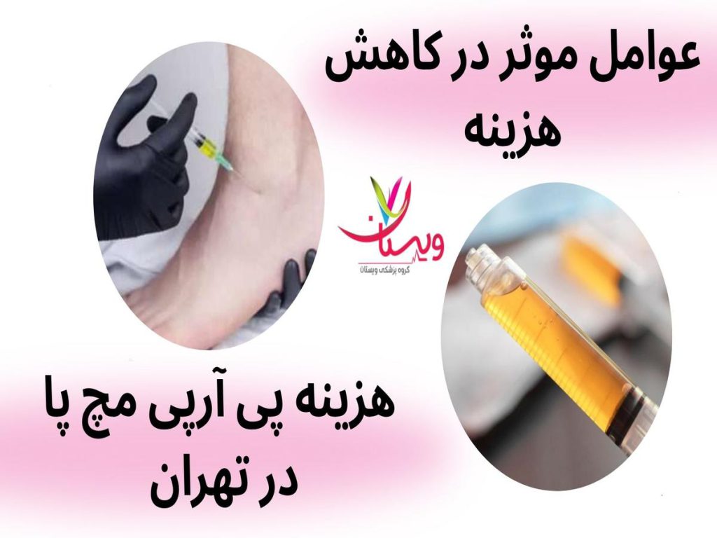 روش درمانی پی آرپی هزینه پی آرپی مچ پا