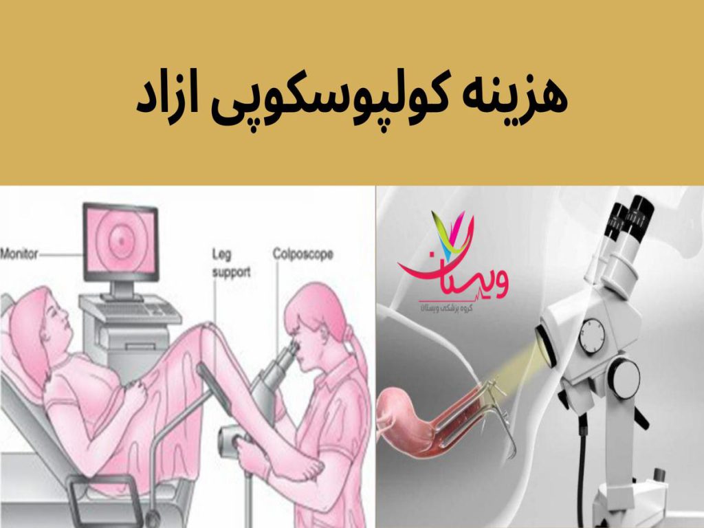 هزینه کولپوسکوپی هزینه کولپوسکوپی ازاد