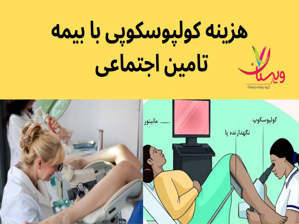 بیمه تأمین اجتماعی هزینه کولپوسکوپی با بیمه تامین اجتماعی