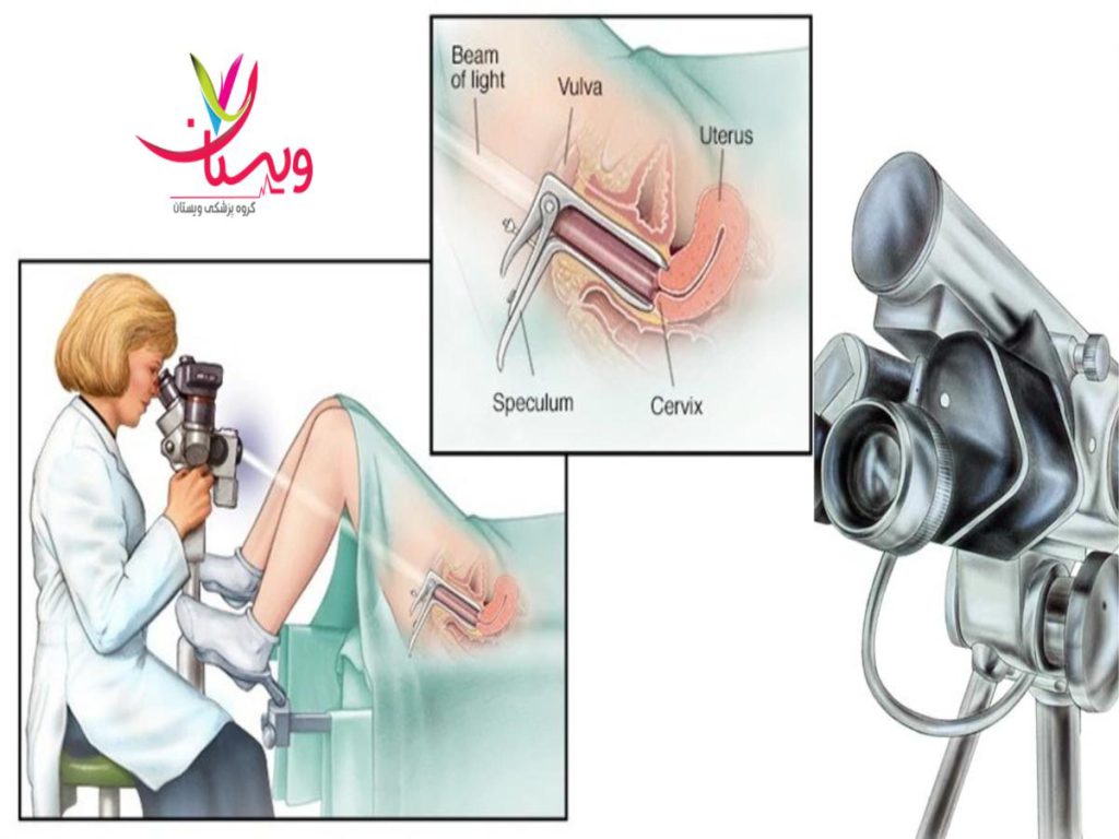 کلینیک ویستان هزینه کولپوسکوپی در کلینیک ویستان