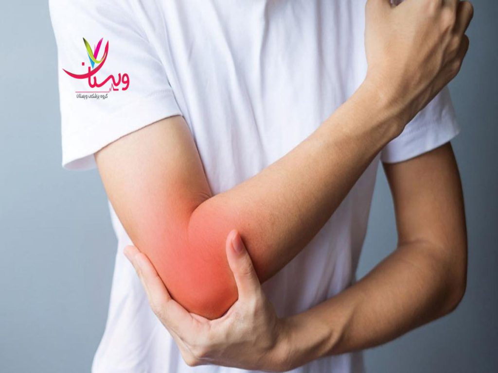 دکتر تنیس البو ویژگی بهترین دکتر تنیس البو