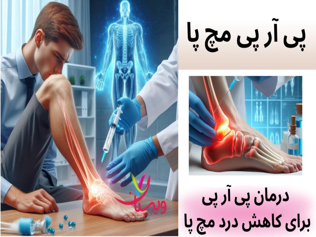 درد مچ پا تزریق پی آر پی مچ پا