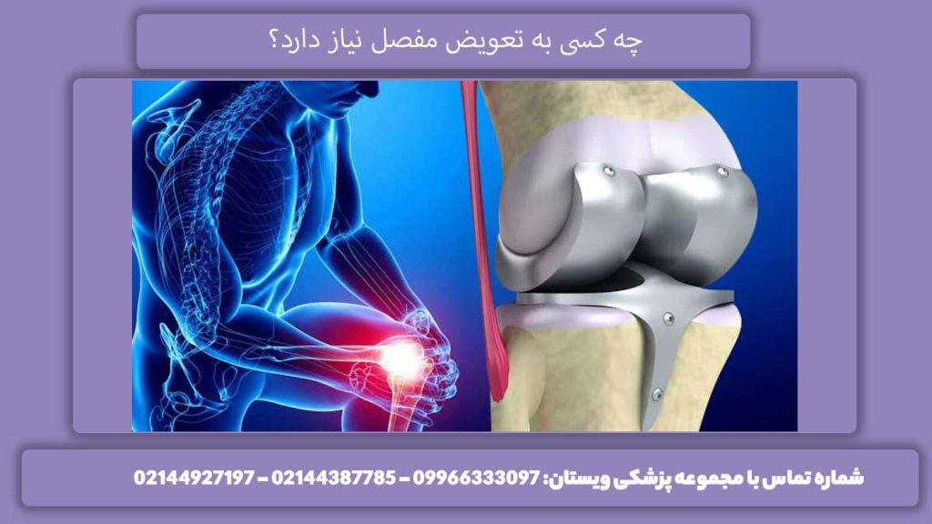 مراجعه به پزشک جراح ضرورت نیاز به جراحی پروتز زانو