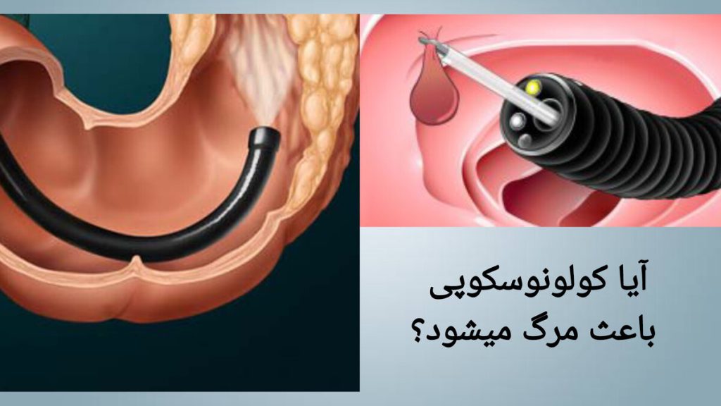 خطرات احتمالی روده بزرگ نمایی از کولونوسکوپی و آیا کولونوسکوپی باعث مرگ میشود