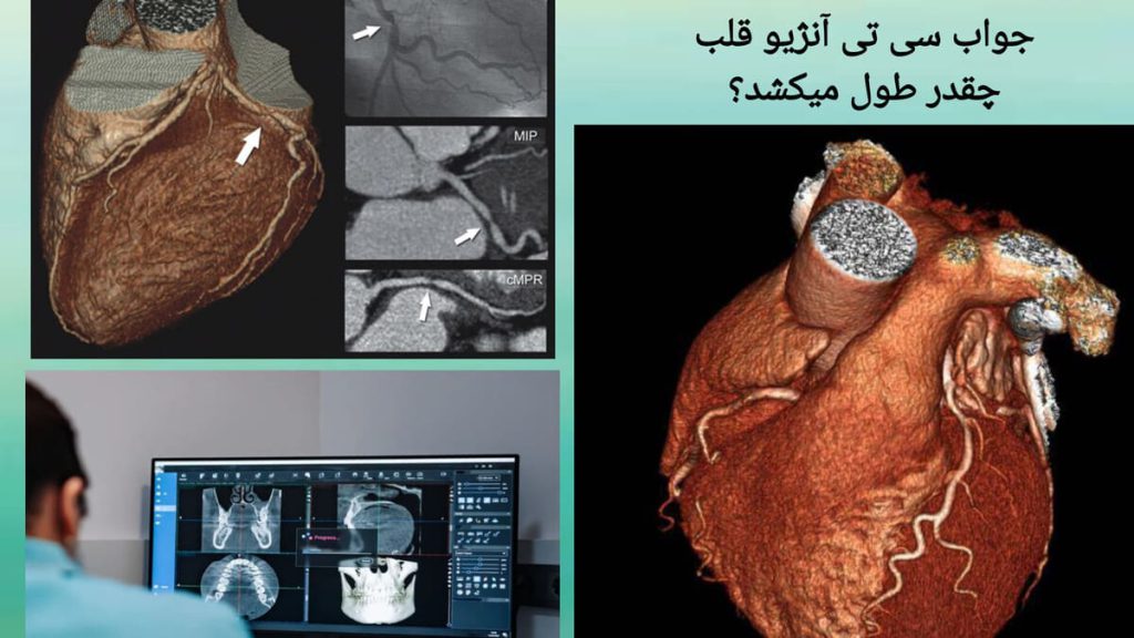 تصاویری از نتیجه سی تی آنژیو قلب نمایی از نتیجه سی تی آنژیو قلب و بررسی توسط پزشک