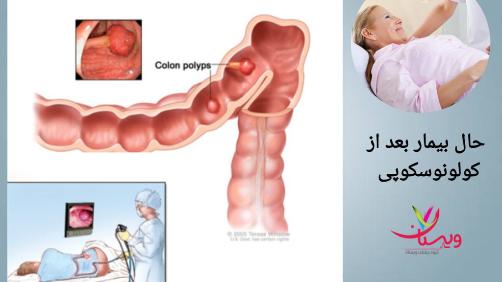 بیمار پس از انجام کولونوسکوپی نمایی از حال بیمار بعد از کولونوسکوپی