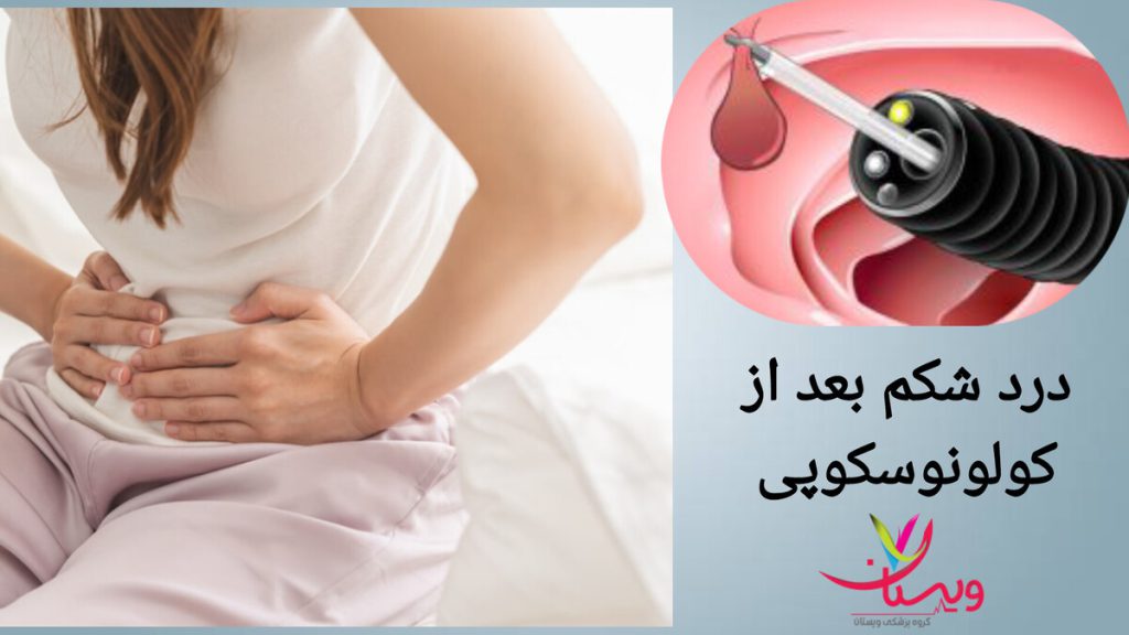 دل درد بعد از کولونوسکوپی خانمی بعد از کولونوسکوپی دچار دل درد شده است.