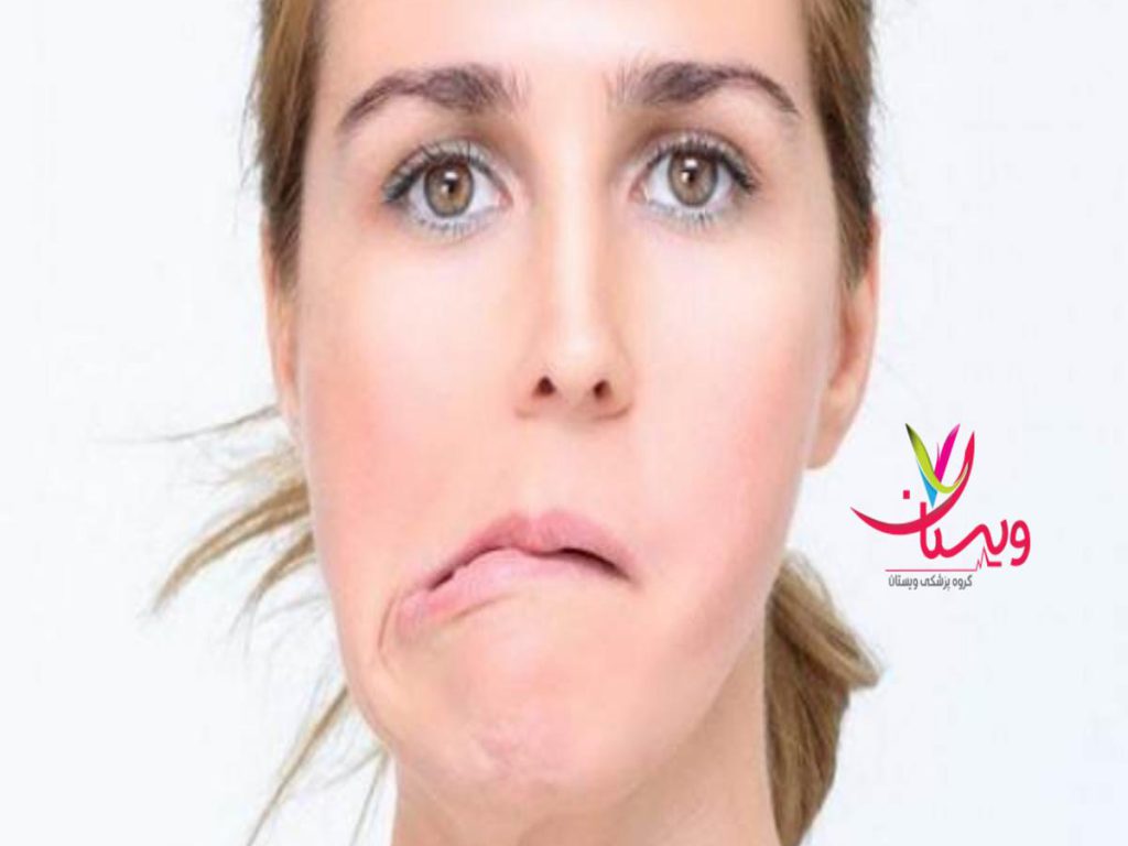 کلینیک مغز و اعصاب سعادت اباد دکتر فلج عصب صورت غرب تهران