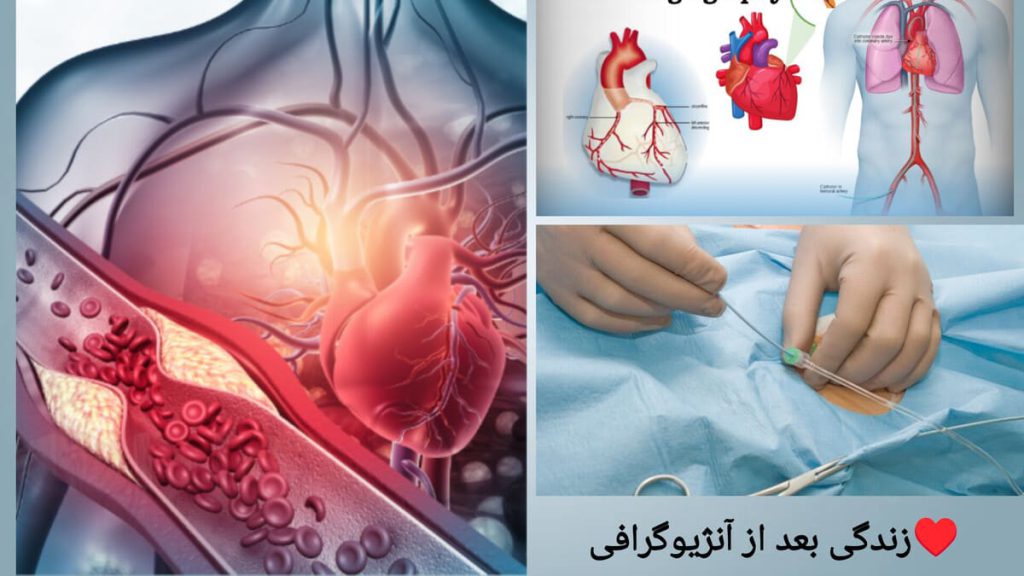 انجام آنژیوگرافی برای بیمار توسط متخصص ماهر نمایی از قلب بیمار و پزشکی که آنژیوگرافی قلب انجام می دهد.