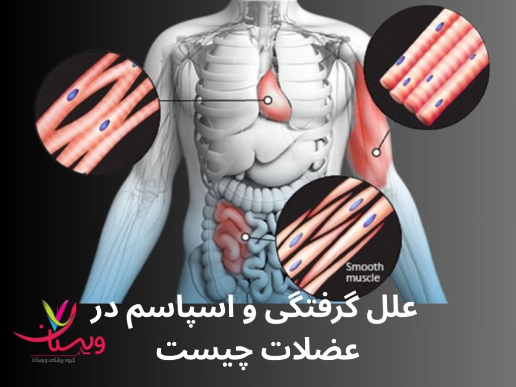علت گرفتگی عضلات