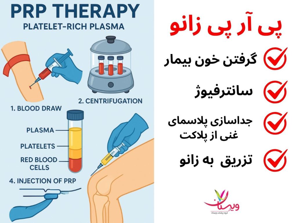 اینفوگرافیک مراحل prp زانو عمل پی آر پی زانو