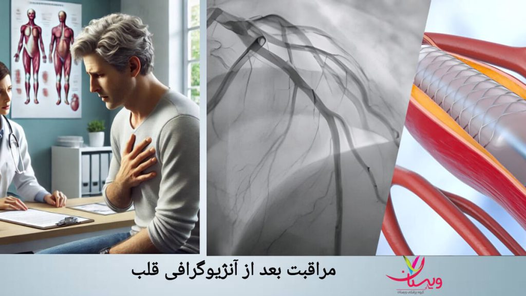 مشورت با پزشک برای انجام مراقبت های لازم بیمار برای پاسخ به سوال مراقبت بعد از آنژیوگرافی قلب چیست، با پزشک مشورت می کند.