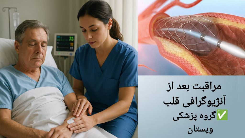 مراقبت های لازم بعد از آنژیوگرافی توسط پزشک برای بیمار