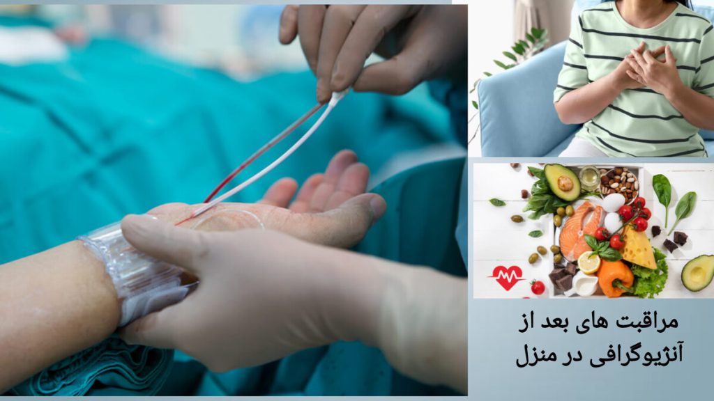 رعایت نکات مهم بعد از آنژیوگرافی انجام آنژیوگرافی و غذاهایی که بعد از آنژیوگرافی بیمار باید مصرف کند.