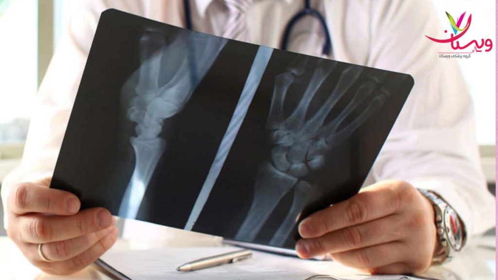 بررسی عکس دست بیمار توسط پزشک پزشک عکس دست بیمار را نگاه می کند.