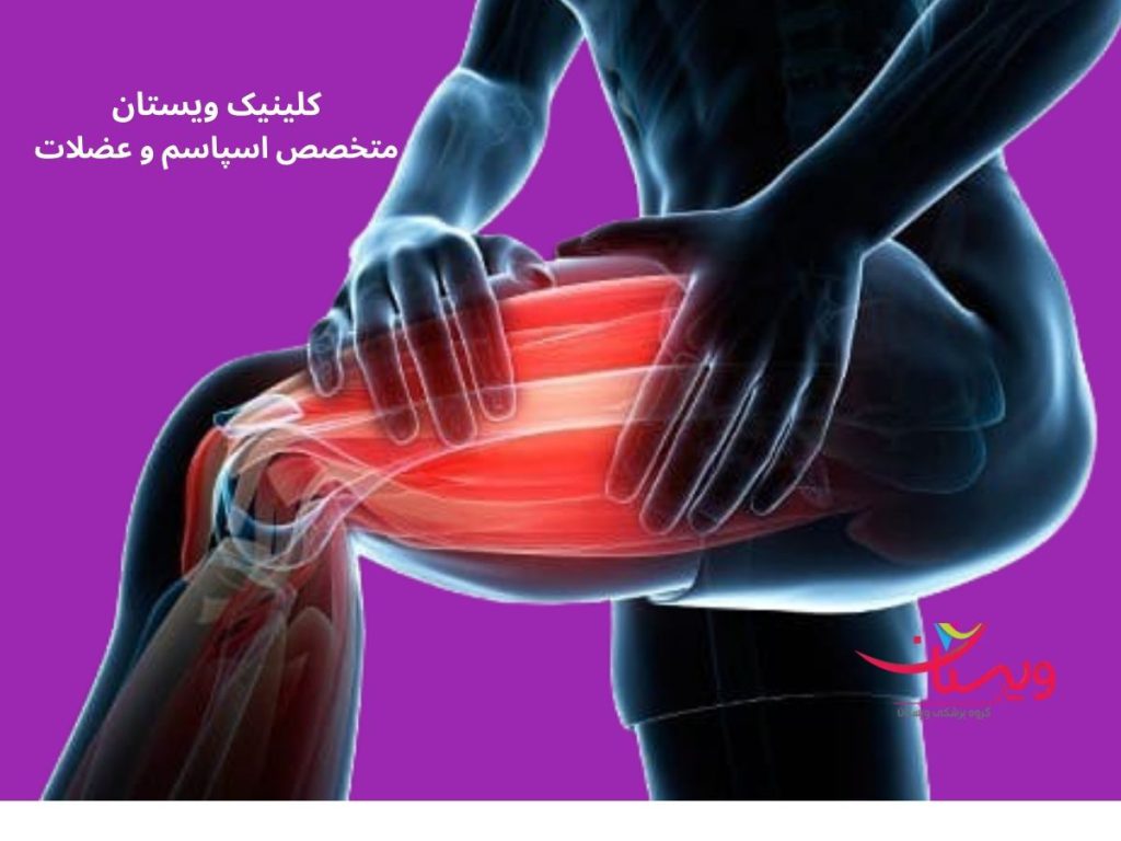 وظیف ی دکتر متخصص برای گرفتگی عضلات