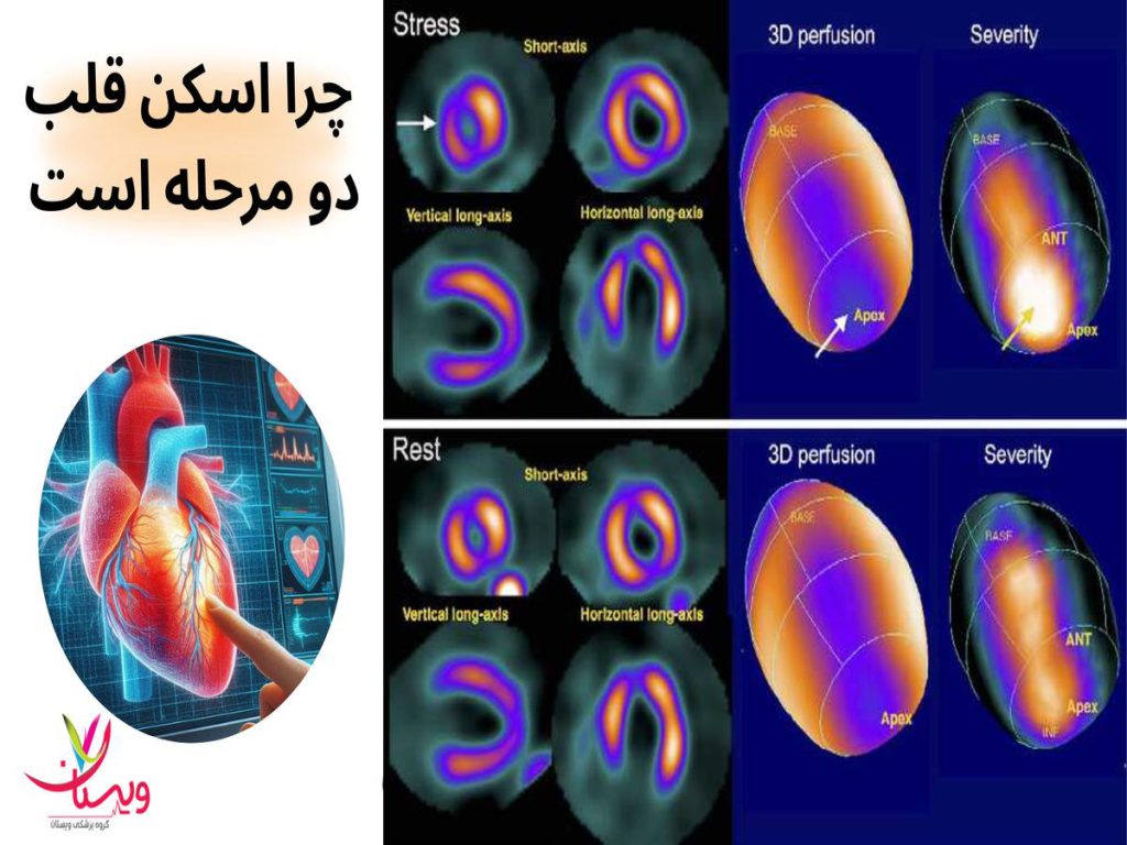 چرا اسکن قلب دو مرحله است؟