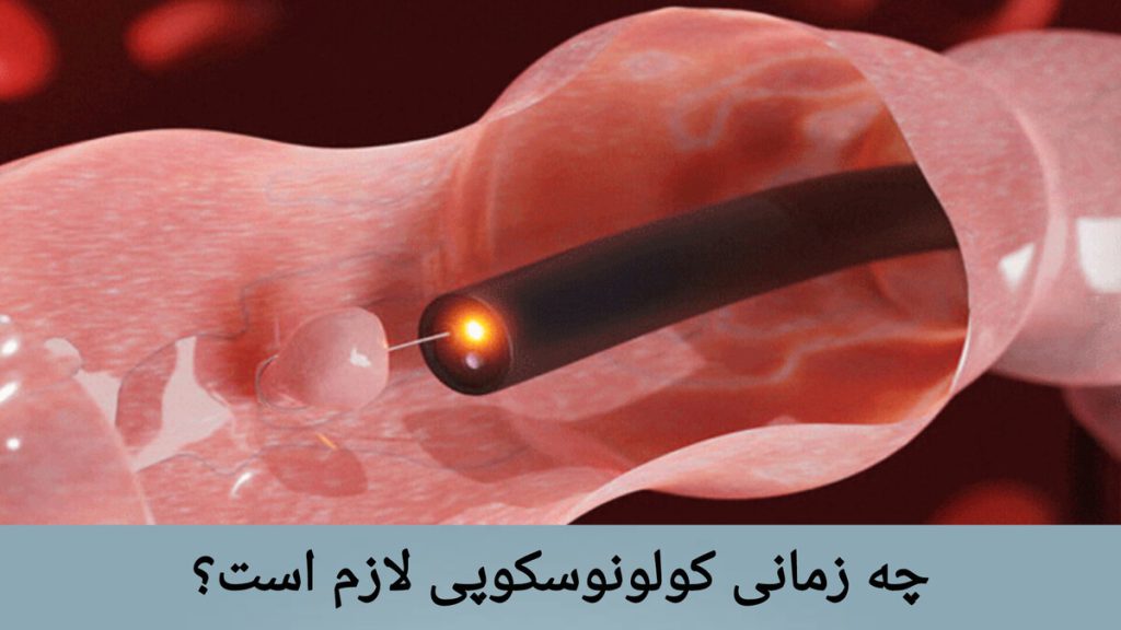 انجام کولونوسکوپی برای بررسی ناهنجاری های روده نمایی از انجام کولونوسکوپی