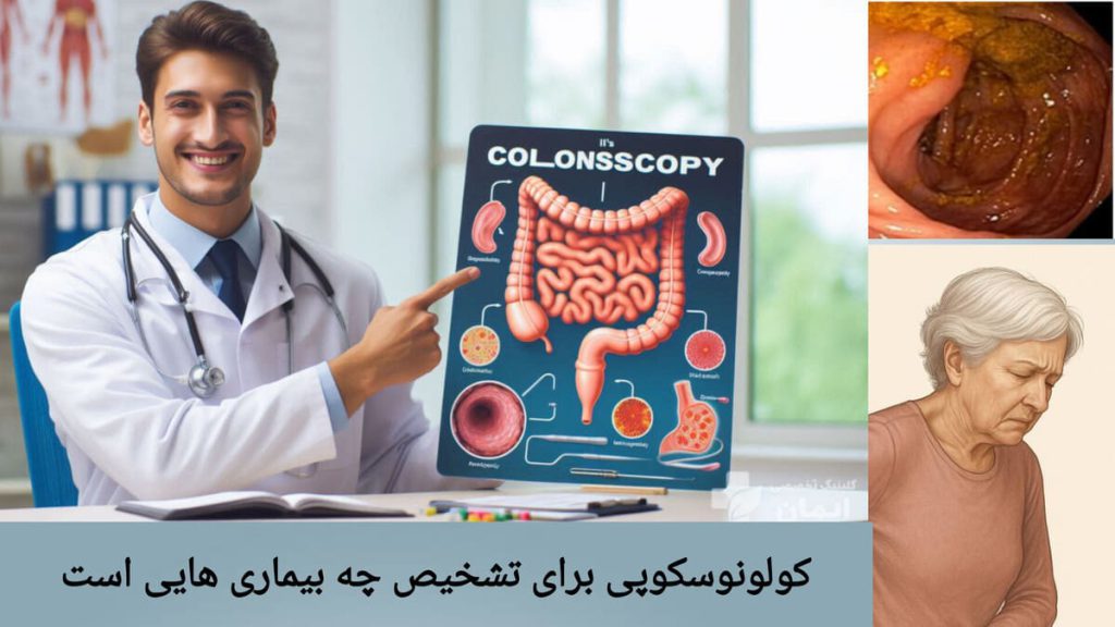 تشخیص بیماری های مربوط به روده با کولونوسکوپی پزشک در حال نشان دادن تصویری از روده بزرگ بیمار