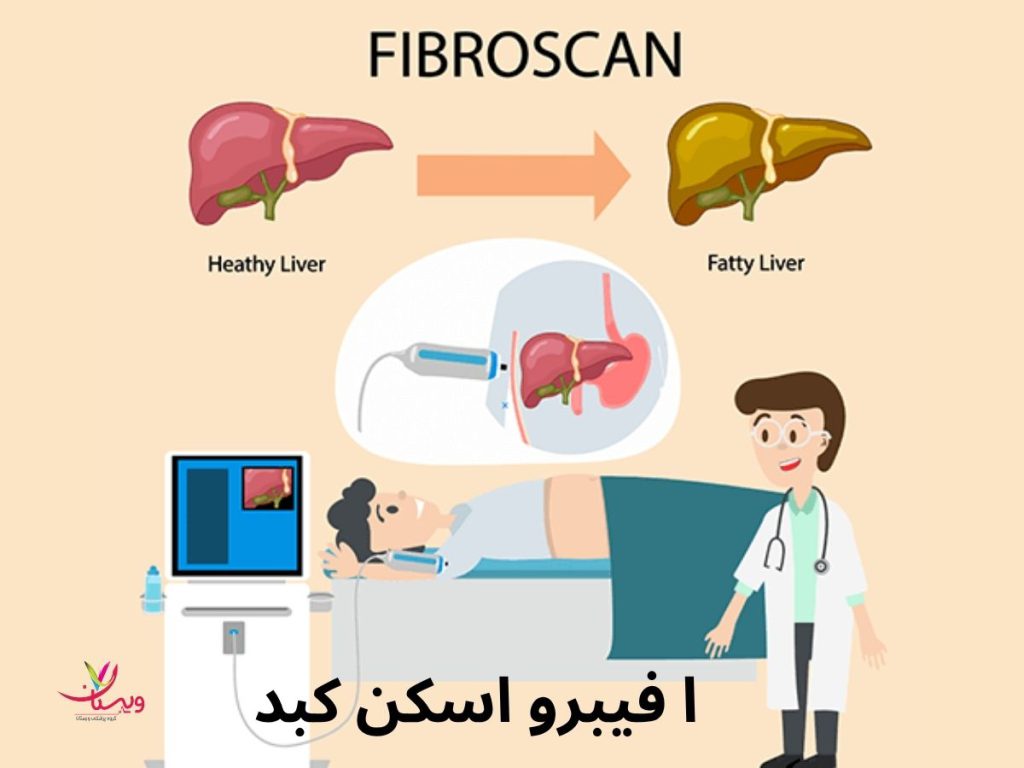 fibroscan اسکن کبد و فیبرو اسکن کبد