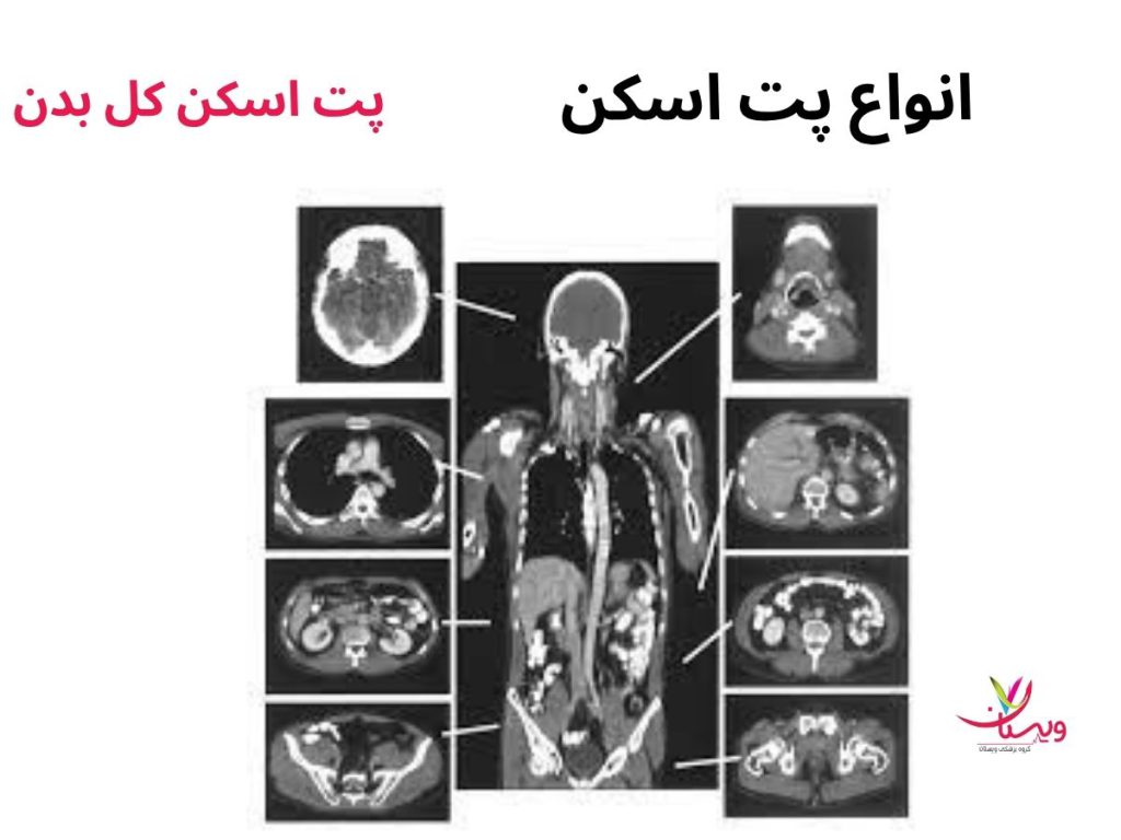 انواع پت اسکن