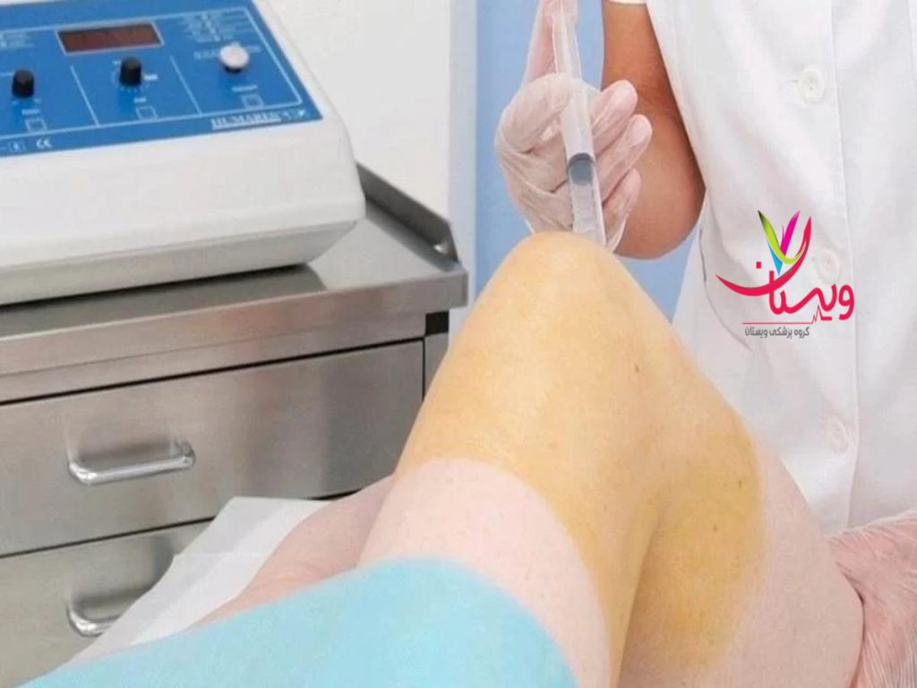 تزریق گاز اوزون اوزون تراپی دیسک کمر در تهران