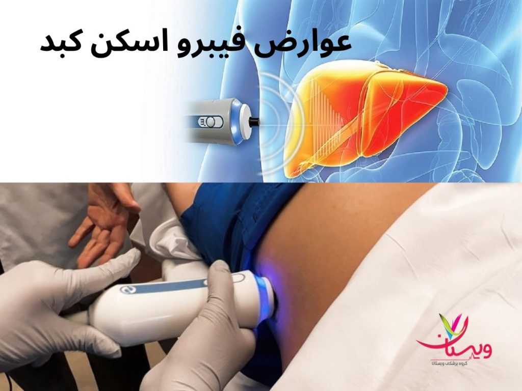 اسکن کبد عوارض فیبرو اسکن کبد