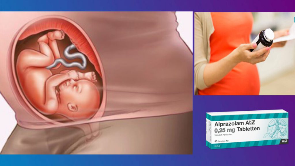 تاثیرات منفی مصرف قرص آلپرازولام بر جنین نمایی از جنین در شکم مادر و خانم بارداری که آلپرازولام می خورد.