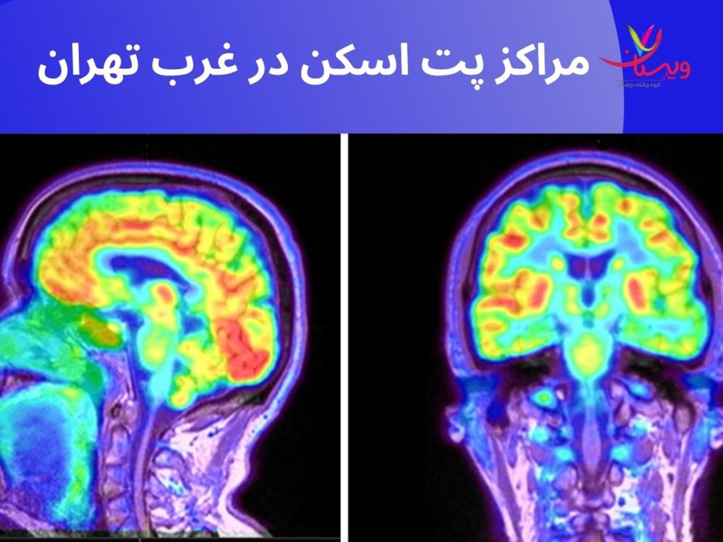 مراکز پت اسکن در غرب تهران