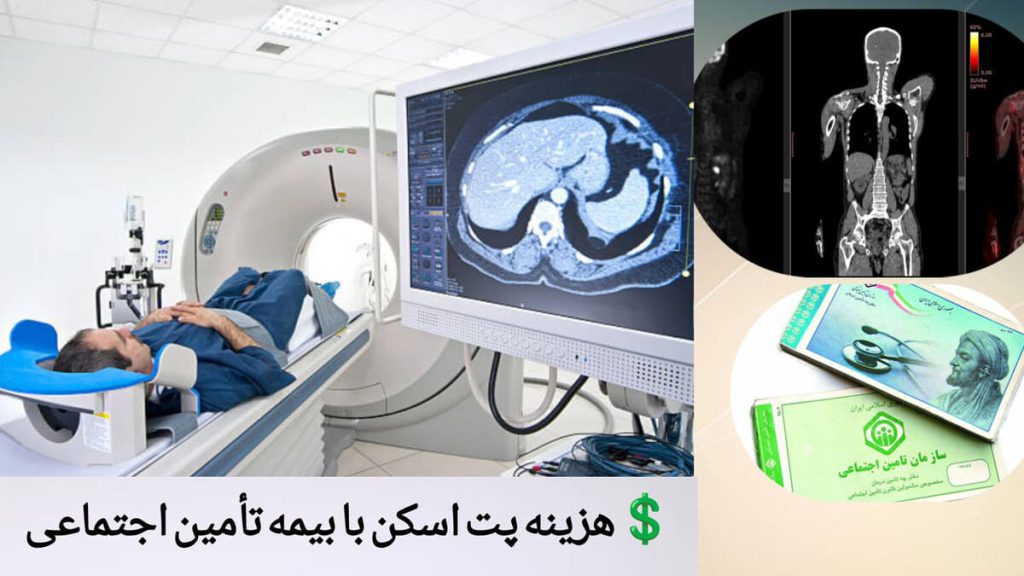 استفاده از بیمه تامین اجتماعی در پت اسکن انجام پت اسکن با دفترچه بیمه تامین اجتماعی