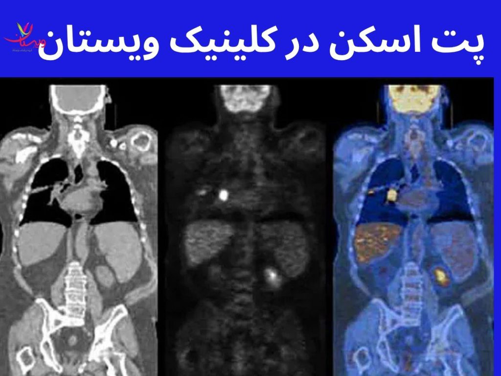 خدمات کلینیک ویستان برای انجام پت اسکن