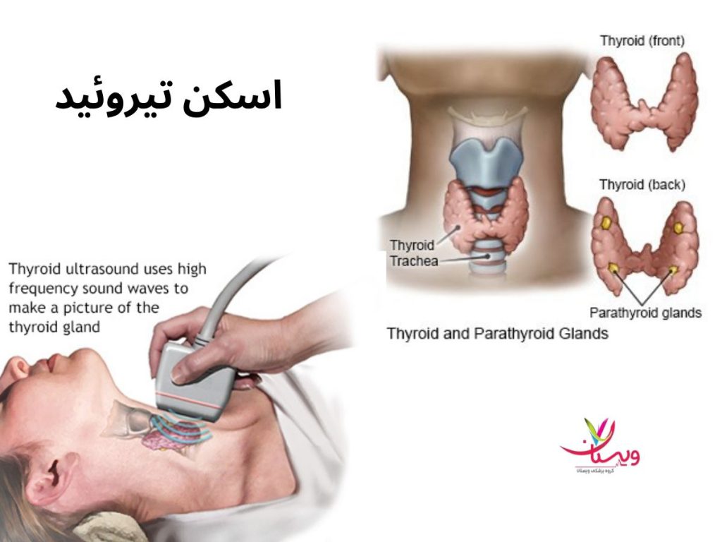 اسکن تیروئید چیست