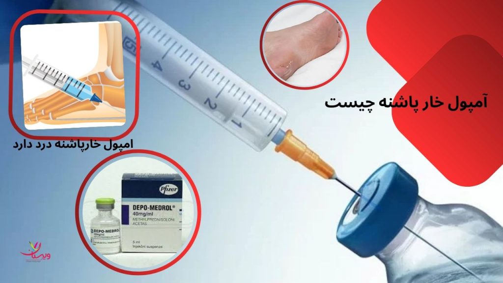 آمپول دپومدرول برای خار پاشنه امپول خارپاشنه درد دارد؟