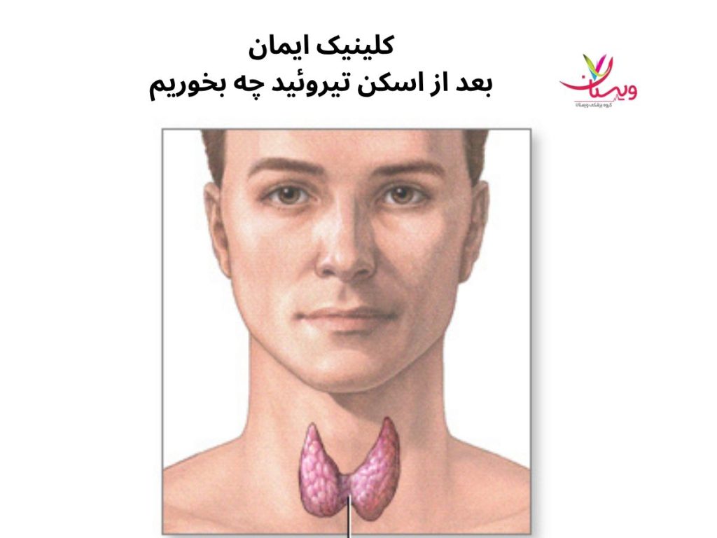 بعد از اسکن تیروئید چه بخوریم