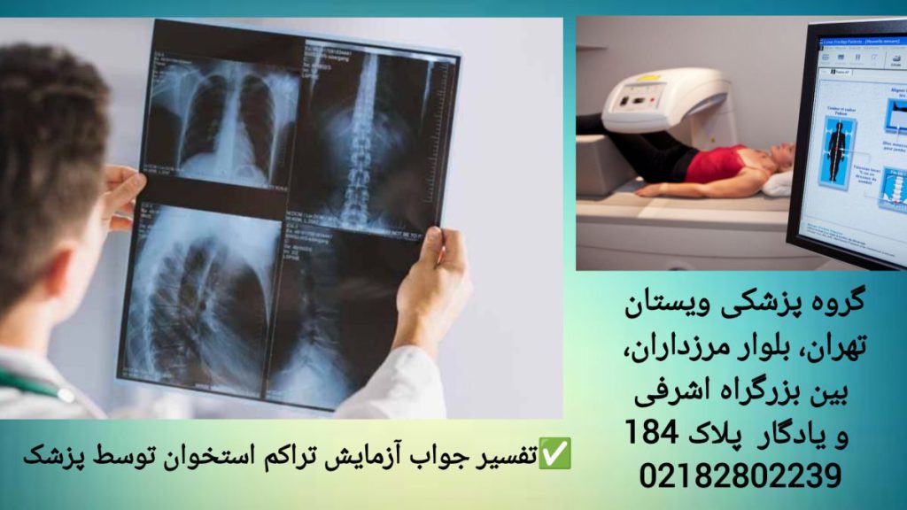 بررسی جواب آزمایش تراکم استخوان توسط پزشک پزشک در حال بررسی جواب آزمایش تراکم استخوان در گروه پزشکی ویستان