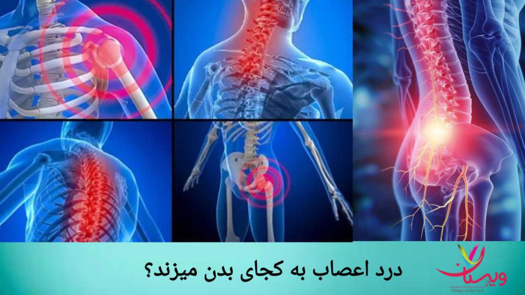 درد اعصاب به کجای بدن میزند
