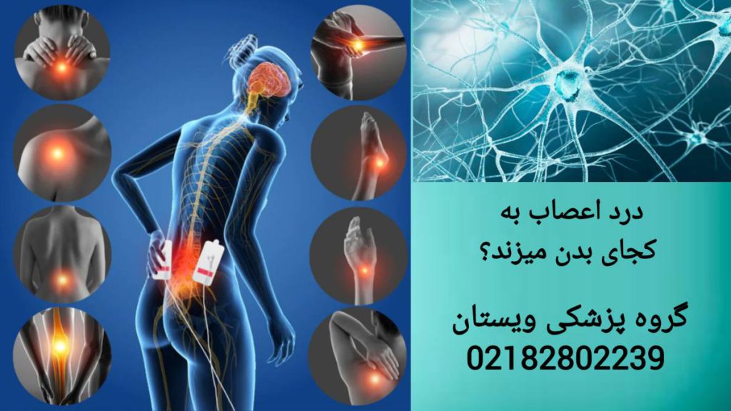 نمایی از بیمار و دردهای عصبی در نقاط مختلف بدن او پاسخ به این سوال که درد اعصاب به کجای بدن میزند