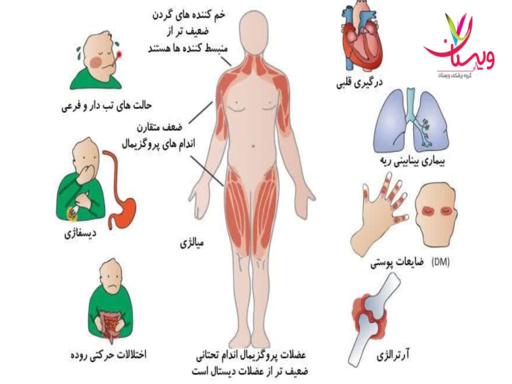 آسیب عضلات درمان قطعی میوپاتی