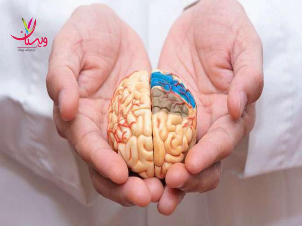 سرعت پیشرفت بیماری زمان مرگ بیماران الزایمری